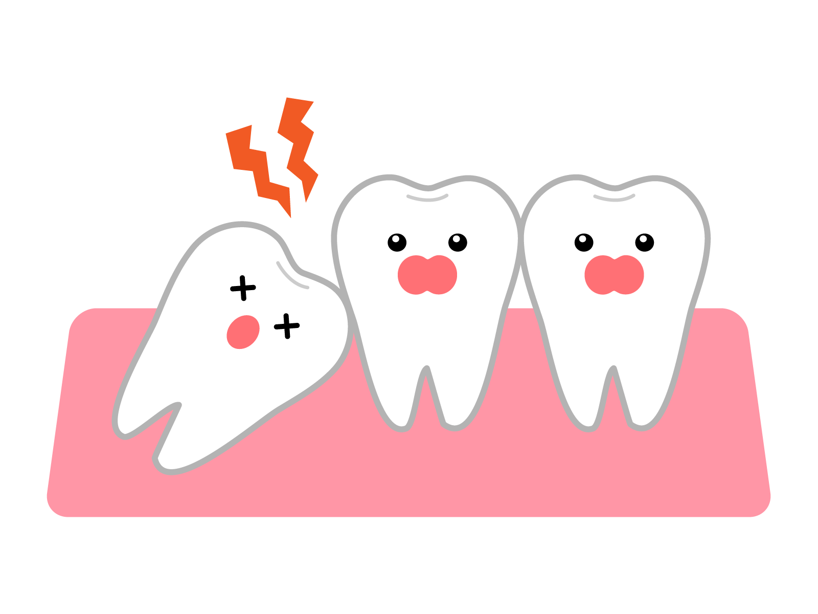 親知らずの抜歯はするべきでしょうか