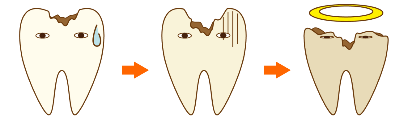 だんだん弱くなる歯